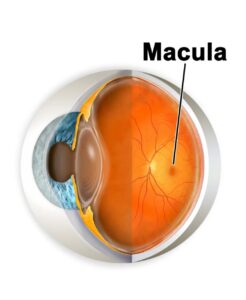 Макулопатия-заболевание глаз